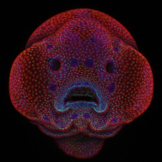 microscopic-fish-face-2016-nikon-small-world-competition